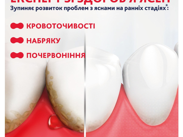 З/п Пародонтакс ультра очищення 75мл